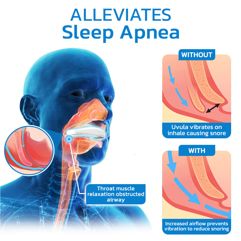 Advance WellSleep Apnea Oral Appliances