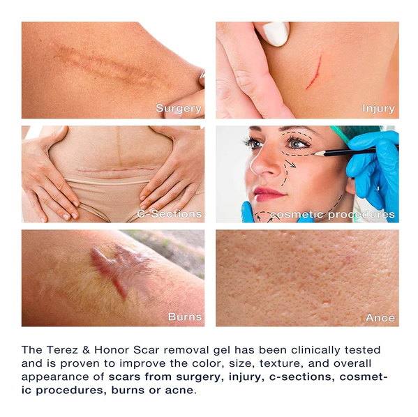 Advanced Silicone Skin Renewal Gel