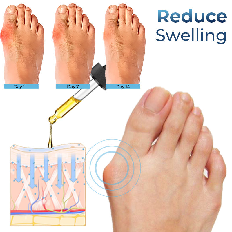 Advance German Bunion Relief Oil
