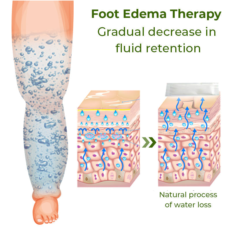 Foot Edema Therapy Patches