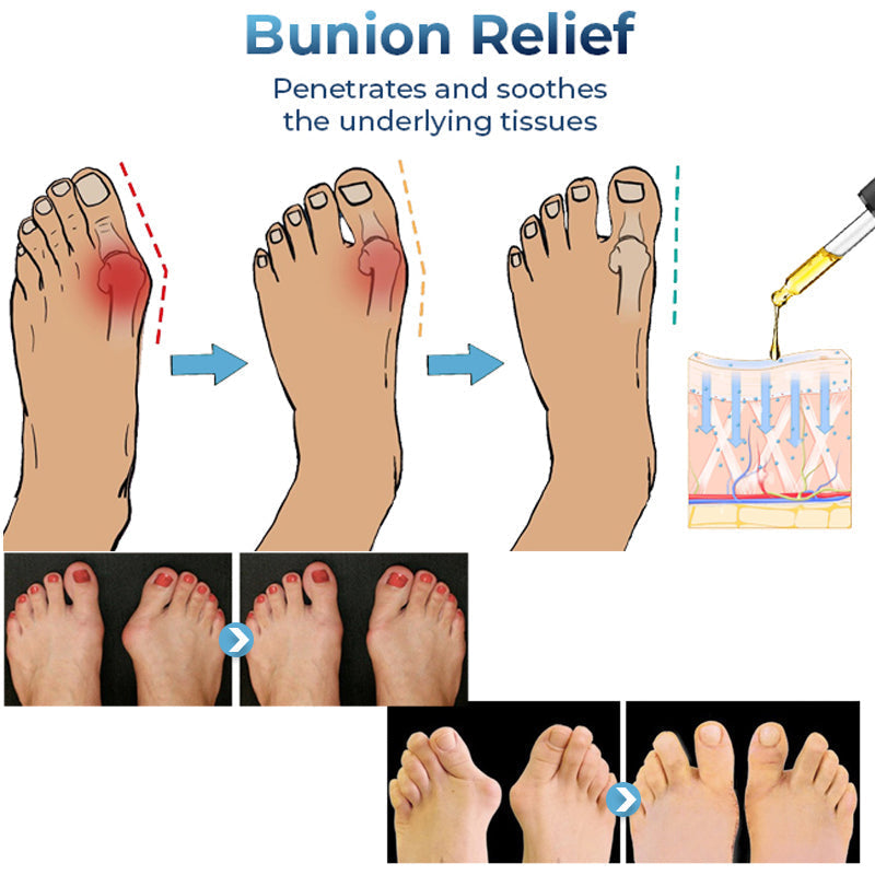 Advance German Bunion Relief Oil