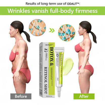 Botox & Retinol Shot - Remove Wrinkles, Sagging Jowls & Puffy Eyes