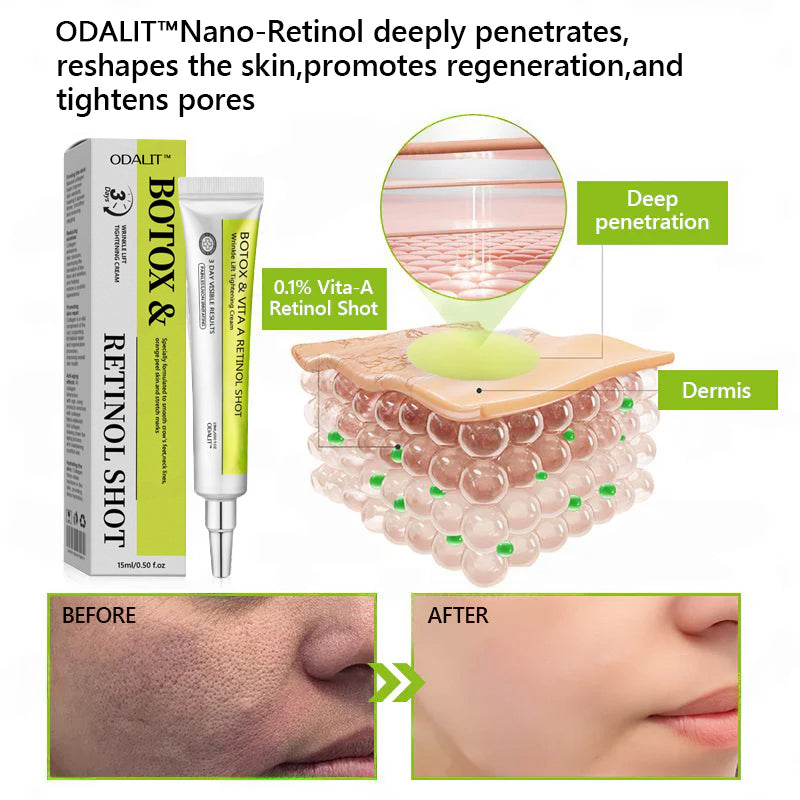Botox & Retinol Shot - Remove Wrinkles, Sagging Jowls & Puffy Eyes