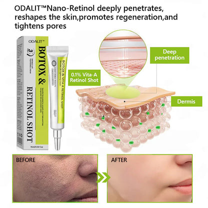 Botox & Retinol Shot - Remove Wrinkles, Sagging Jowls & Puffy Eyes