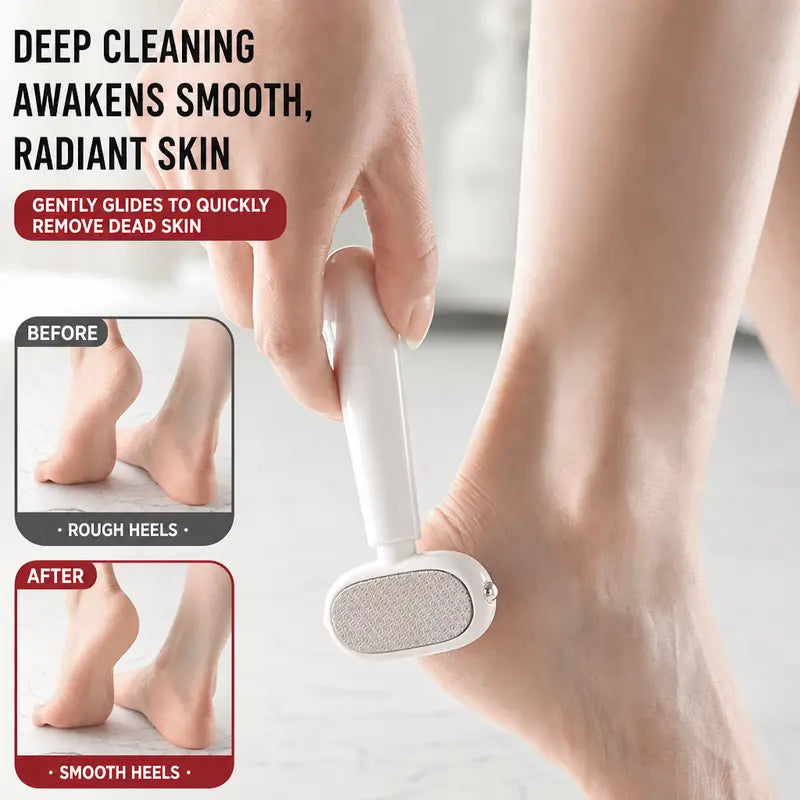 SoftHeel™ — Rough Heels, Renewed in Minutes