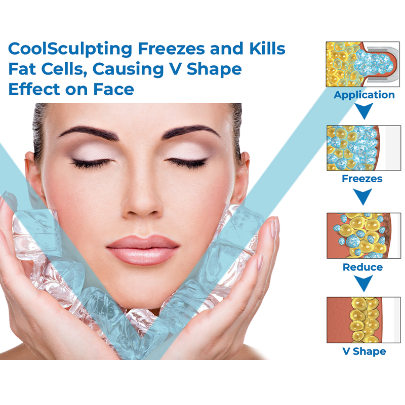 Anti-glycation CoolSculpting Mask