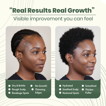 Batana Oil Natural Hair Growth