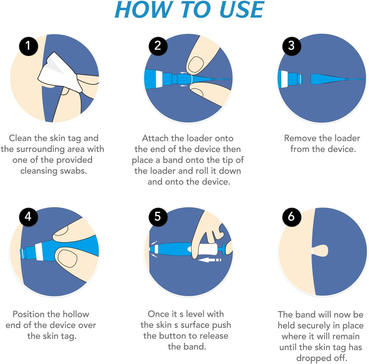 Painless Skin Tag Removal Kit