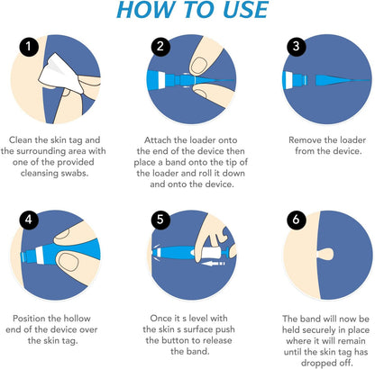 Painless Skin Tag Removal Kit