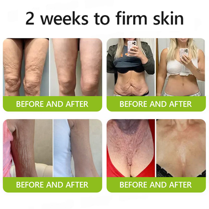 Botox & Retinol Shot - Remove Wrinkles, Sagging Jowls & Puffy Eyes
