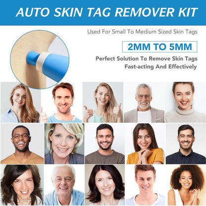 Painless Skin Tag Removal Kit
