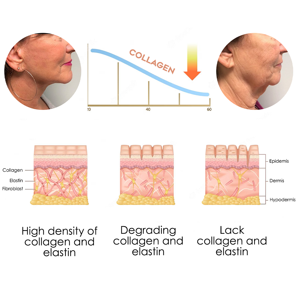 NeckUp Collagen Whitening Cream