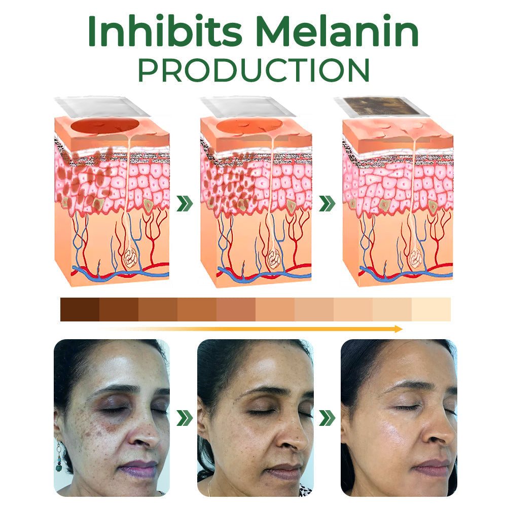 WHITEBEAR Pigmentation Correction Bamboo Arbutin Pads