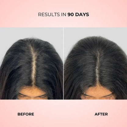 GlowUp™ — LED Hair Growth Stimulating Brush