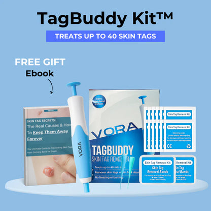 Tag Removal Kit