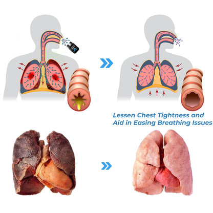 Herbal Breathe Respiratory Cleansing Aerosolizer