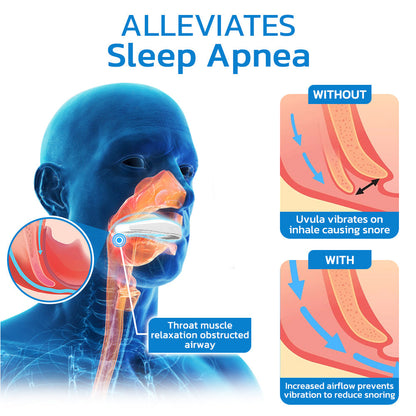 Advance WellSleep Apnea Oral Appliances