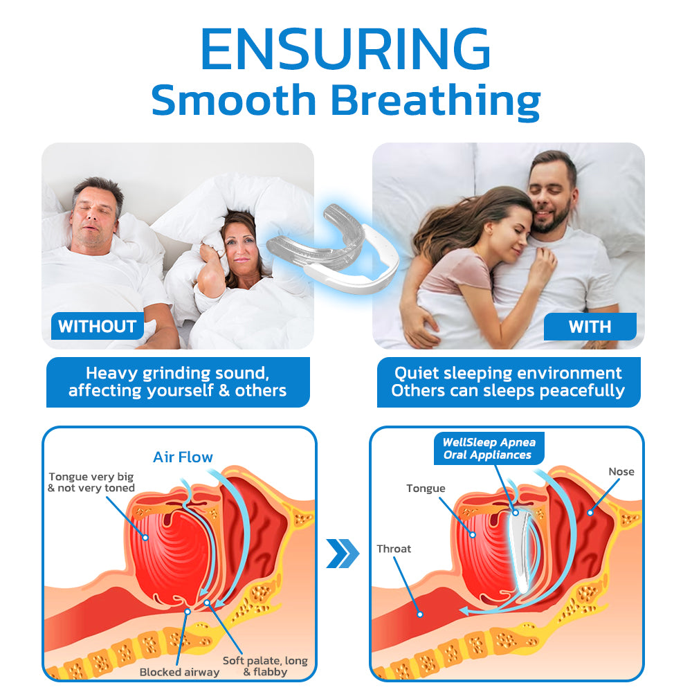 Advance WellSleep Apnea Oral Appliances