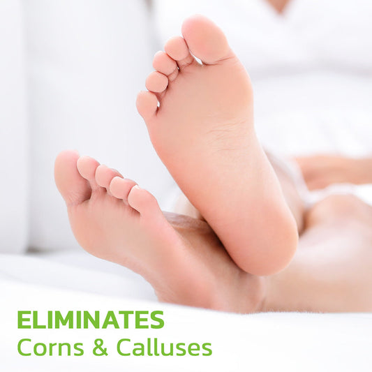 Advanced Herbal Foot Callus And Corns Removal Soak