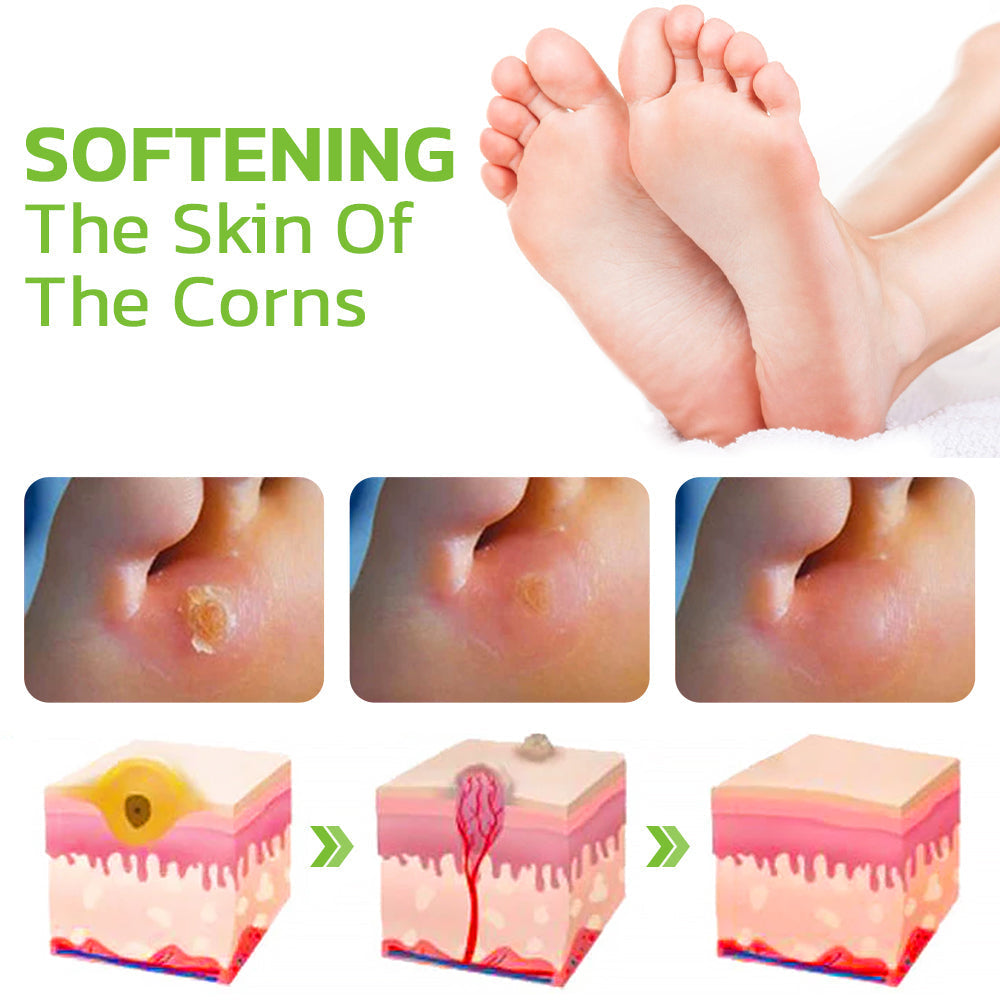Advanced Herbal Foot Callus And Corns Removal Soak
