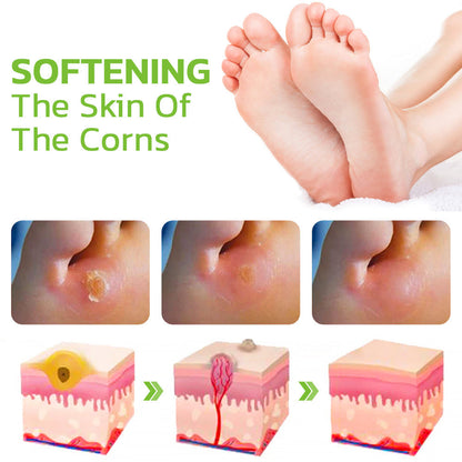 Advanced Herbal Foot Callus And Corns Removal Soak