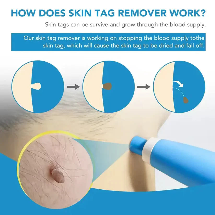 Tag Removal Kit