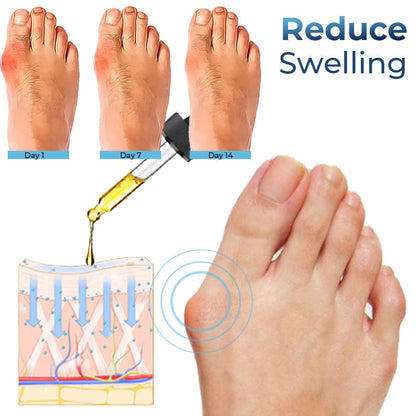 Advance German Bunion Relief Oil