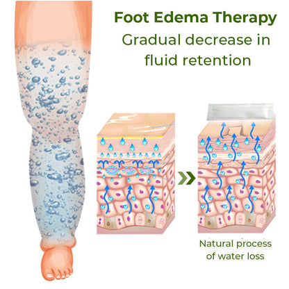 Foot Edema Therapy Patches