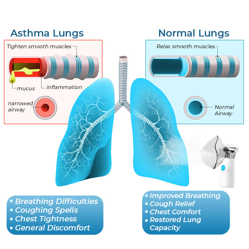 Advance LungDetox Nebulizer Cleansing Spray