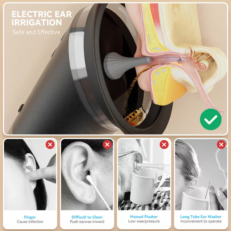 ClearCanal™ — Crystal clear EarWax Removal